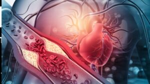 Cardiovascular Diseases: Symptoms, Causes & risk factors
