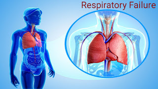 Respiratory Failure Symptoms and Causes