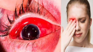 Eye Injury symptoms and causes