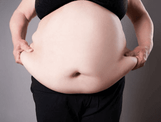 obesity symptoms causes and treatment
