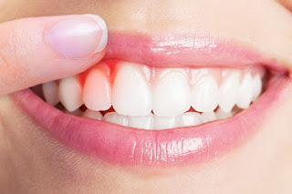 Gums pain symptoms and causes