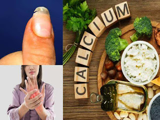 Calcium Deficiency Symptoms and Causes